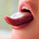 10 types of tongue glossitis with photos that will make everyone wary