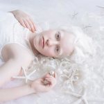 Albinos - character