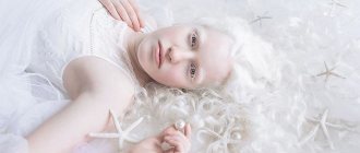 Albinos - character