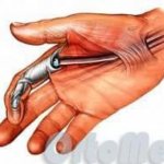 Анатомия фаланги пальцев рук. Особенности строения 05