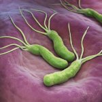 Helicobacter bacterium: symptoms and causes