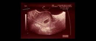 Pregnancy 5-6 weeks. Fertilized egg. Stages of development 