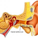 болезни уха