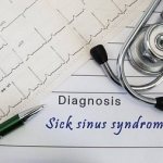 Diagnosis and treatment of sick sinus syndrome