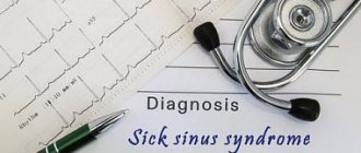 Диагностика и лечение синдрома слабости синусового узла