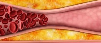 If a large amount of cholesterol enters the blood, its excess remains in the bile