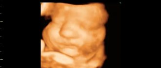 Ultrasound photo at 35 weeks of pregnancy
