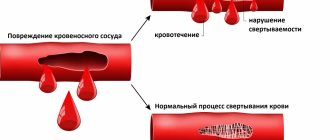 hemophilia.jpg