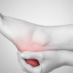How to treat heel spurs at home