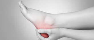How to treat heel spurs at home
