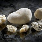 Kidney stones. What you need to know and how to treat correctly 