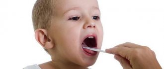 Treatment of acute laryngitis in children