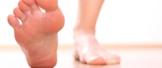 treatment of flat feet