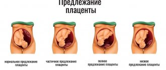Низкая плацента при беременности: чем опасна и как рожать