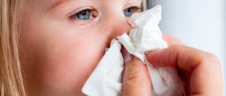 Nosebleeds in children: symptoms