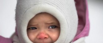 frostbite in children
