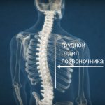 Osteochondrosis of the thoracic spine