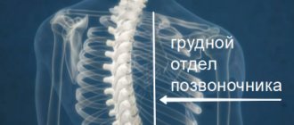 Osteochondrosis of the thoracic spine
