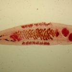 The parasite that causes opisthorchiasis