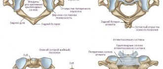 Subluxation of the cervical vertebra (subluxation of the atlas)