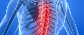 При остеохондрозе могут появится боли в грудной клетке