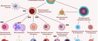 Scheme of hematopoiesis with precursor cells of acute myeloid leukemia