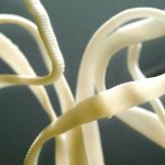 Broad tapeworm - how to identify it in the body