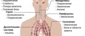 Symptoms of viral mononucleosis