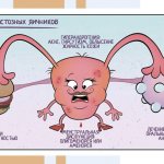 Синдром поликистозных яичников (СПКЯ) - Изображение №1