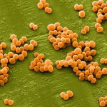 Staphylococcus: how to identify and cure