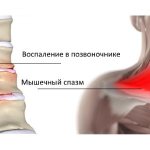 Depending on the causes of dorsalgia, the pain syndrome can be vertebrogenic and non-vertebrogenic