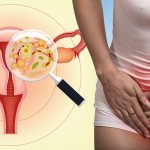 Inflammation of the female genital organs
